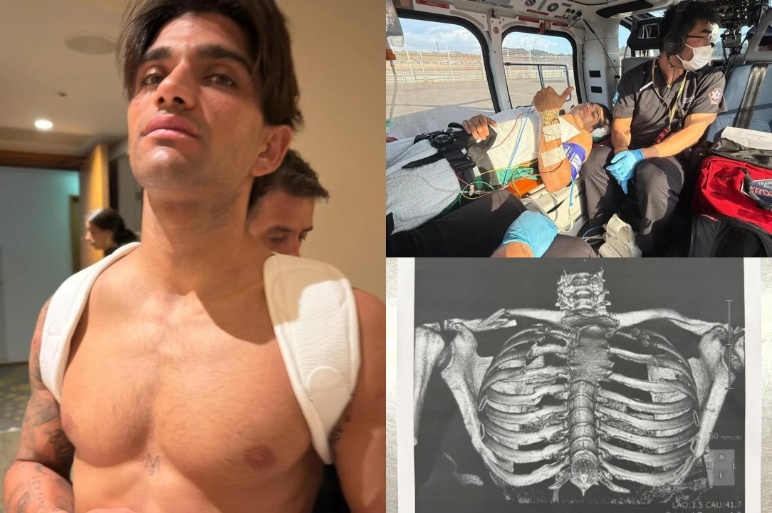 A shirtless man with dark hair and a serious expression stands in a hotel corridor. In another image, he is lying on a stretcher inside an ambulance with medical personnel attending to him. The third image shows a medical scan of his chest, highlighting the ribcage and spine.